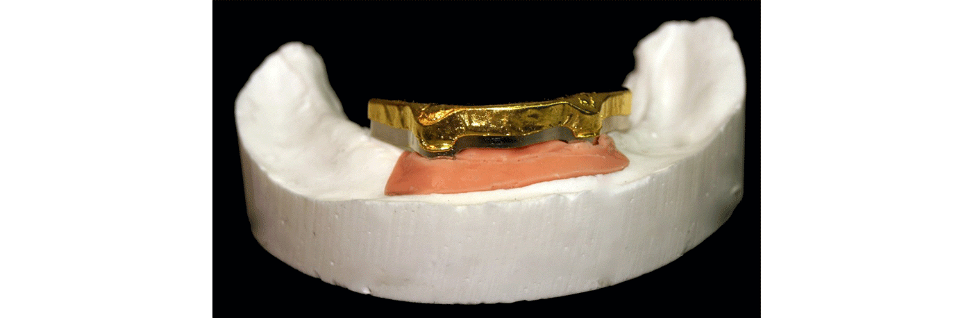 SliderSobreImplantes2