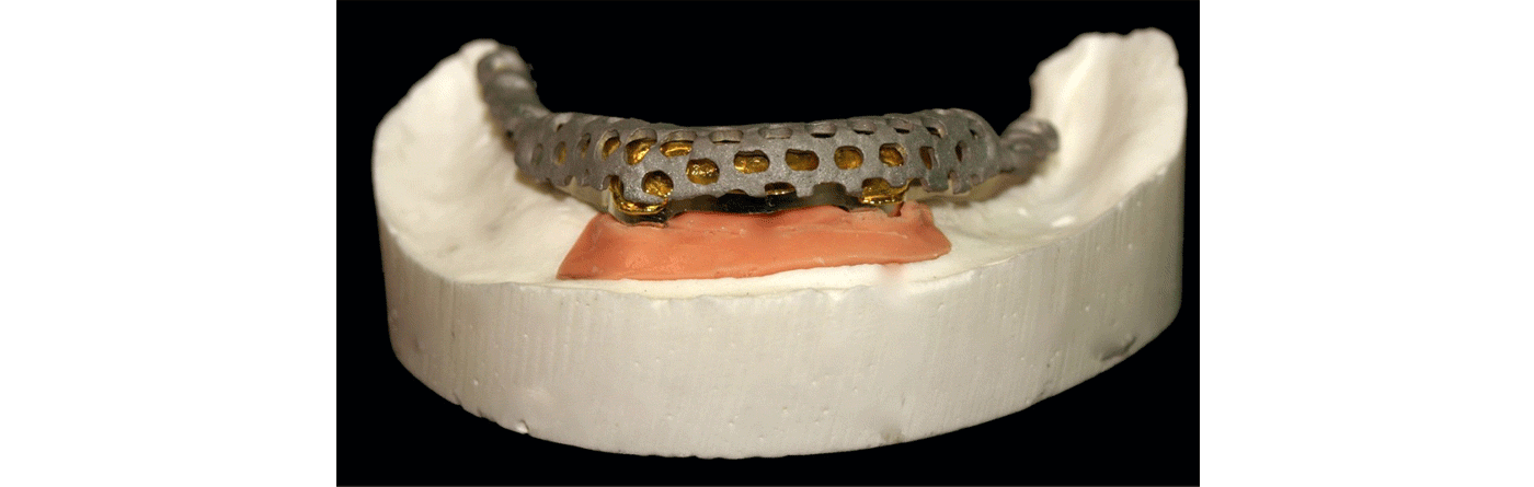 SliderSobreImplantes3