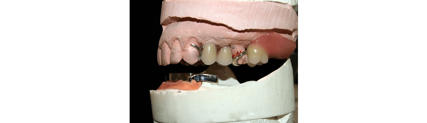 SliderSobreImplantes4