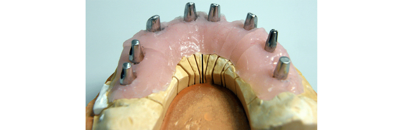 SliderSobreImplantes5