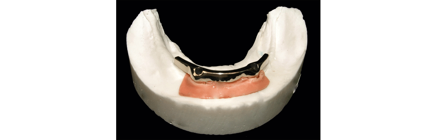 SliderSobreImplantes6