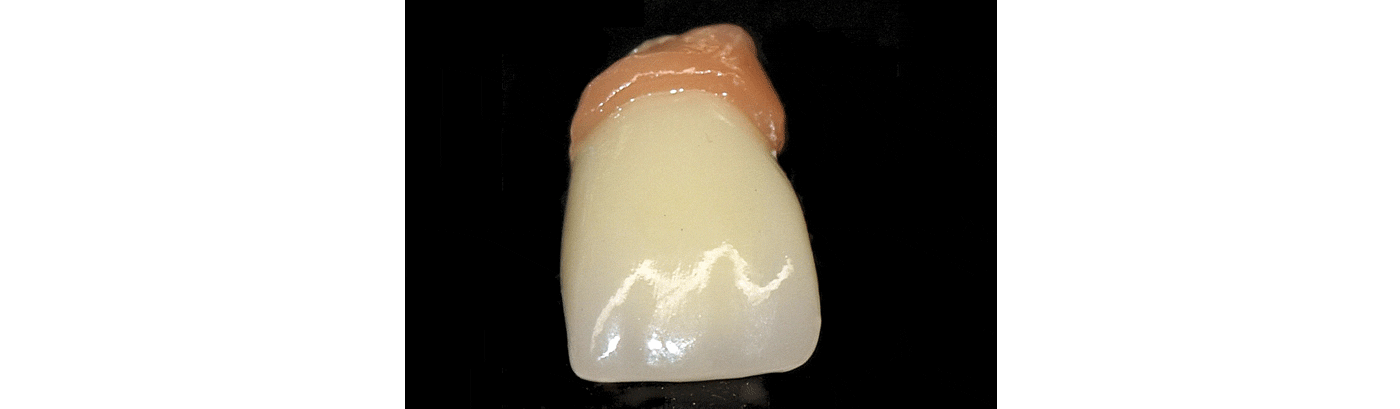 SliderSobreImplantes7