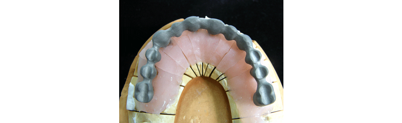 SliderSobreImplantes8