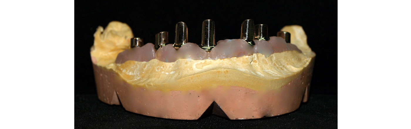 SliderSobreImplantes9